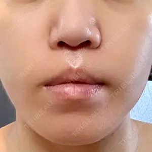 B-LINE CLINIC B-LINE CLINIC 池袋院口コミ