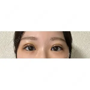 湘南美容クリニック 湘南美容クリニック 池袋東口院口コミ