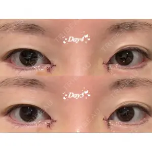 銀座マイアミ美容外科口コミ