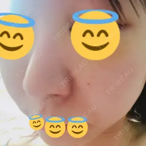 シエルクリニック口コミ