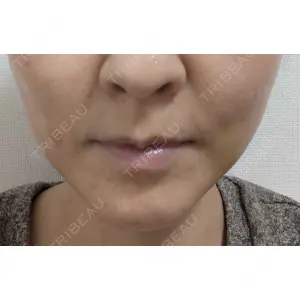 形成外科と美容外科のクリニック池袋口コミ