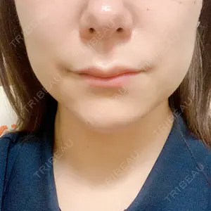 口コミ