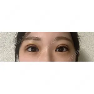 湘南美容クリニック 湘南美容クリニック 池袋東口院口コミ