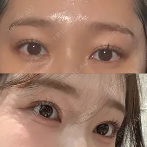 LUHO（ルホ）美容外科口コミ