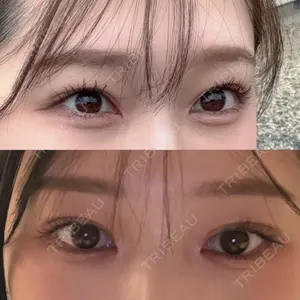 LUHO（ルホ）美容外科口コミ