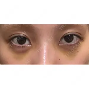 APOLLO BEAUTY CLINIC口コミ