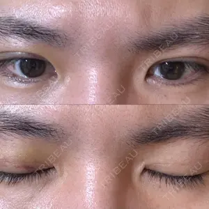 口コミ