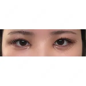 HAAB×DREAM BEAUTY CLINIC HAAB×DREAM BEAUTY CLINIC 大阪梅田院口コミ