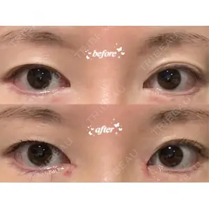 銀座マイアミ美容外科口コミ
