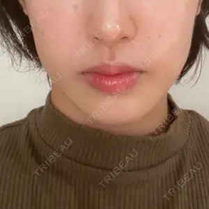 口コミ