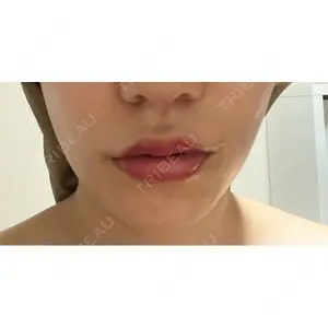 口コミ