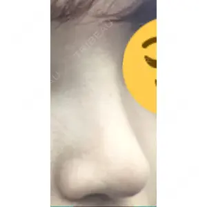 HANABI整形外科口コミ