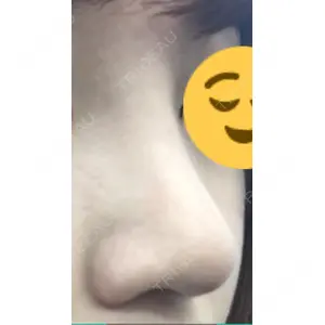 HANABI整形外科口コミ
