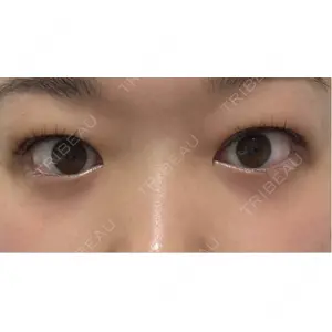 口コミ