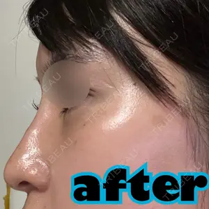 NARU Beauty Clinic NARU Beauty Clinic 【ナルクリ】 水戸院口コミ