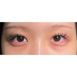 HAAB×DREAM BEAUTY CLINIC HAAB×DREAM BEAUTY CLINIC 大阪梅田院口コミ