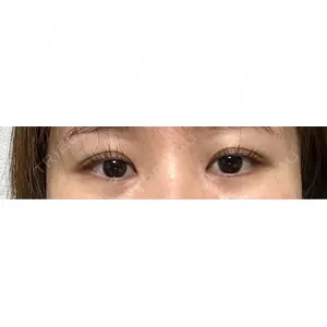 口コミ