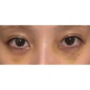 APOLLO BEAUTY CLINIC口コミ