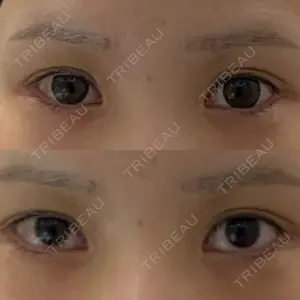 BIANCA CLINIC BIANCA銀座口コミ