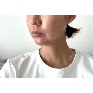 口コミ