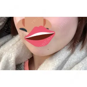 口コミ