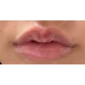 口コミ