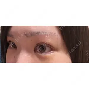 口コミ
