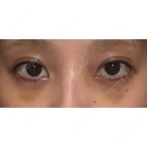 APOLLO BEAUTY CLINIC口コミ