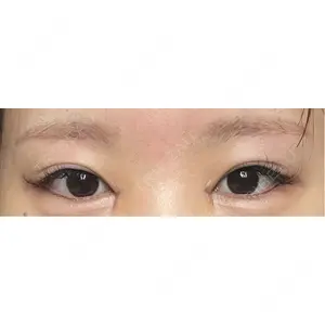 HAAB×DREAM BEAUTY CLINIC HAAB×DREAM BEAUTY CLINIC 大阪梅田院口コミ
