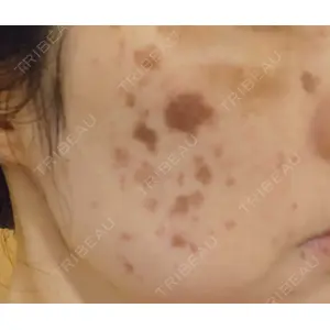 A CLINIC（エークリニック） A CLINIC（エークリニック） 横浜院口コミ