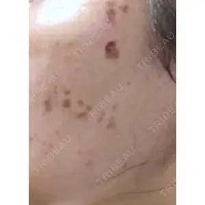 A CLINIC（エークリニック） A CLINIC（エークリニック） 横浜院口コミ