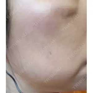 A CLINIC（エークリニック） A CLINIC（エークリニック） 横浜院口コミ