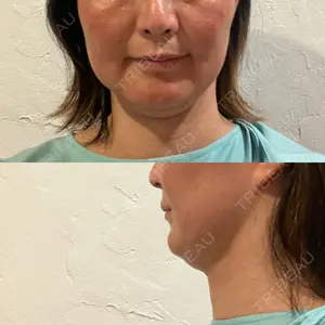 湘南美容クリニック 湘南美容クリニック 藤沢院口コミ