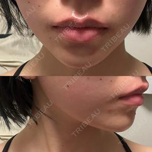 TCB東京中央美容外科 TCB東京中央美容外科 渋谷西口院口コミ