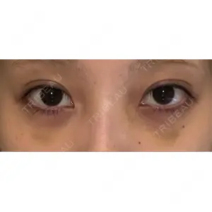 APOLLO BEAUTY CLINIC口コミ