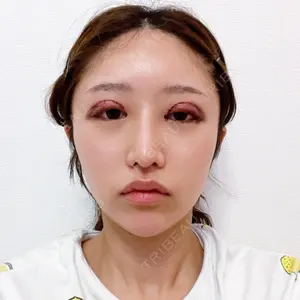 口コミ