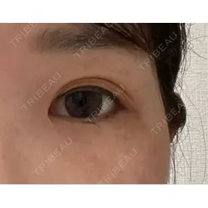アリエル美容クリニック アリエル美容クリニック 大宮院口コミ