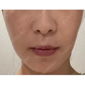アリエル美容クリニック アリエル美容クリニック 大宮院口コミ