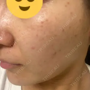 ハナビューティークリニック口コミ