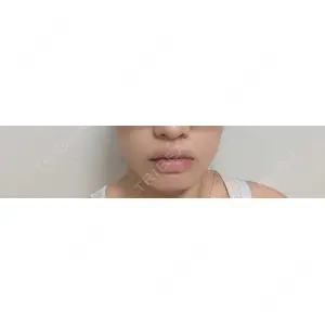 DMTC CLINIC DMTC CLINIC 日本橋院口コミ