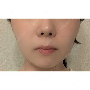 口コミ