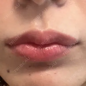 ルラ美容クリニック ルラ美容クリニック 新宿院口コミ