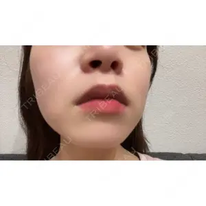 口コミ