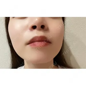 口コミ