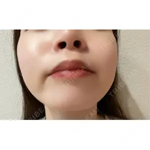 口コミ