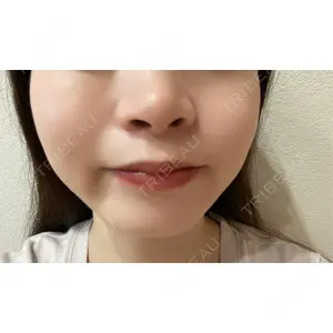 口コミ