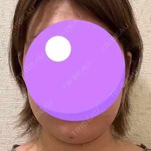 DMTC美容皮膚科 DMTC美容皮膚科 渋谷院口コミ