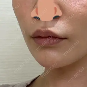 口コミ