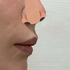口コミ