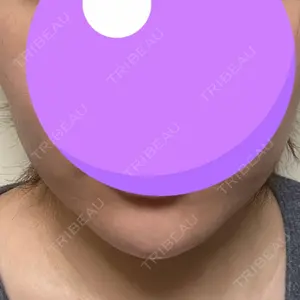 DMTC美容皮膚科 DMTC美容皮膚科 渋谷院口コミ